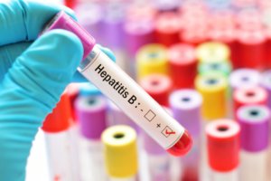 Hepatitis B Positive