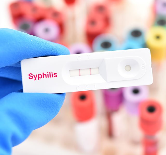 Syphilis Increase
